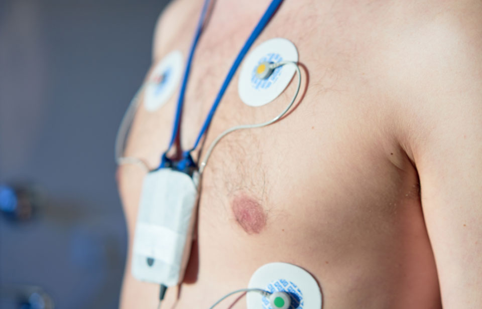 Paciente con electrodos y registrador de Holter ECG